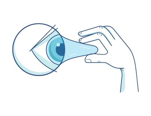 Retirer une lentille de contact d’un œil.