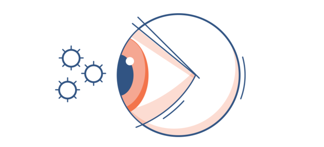 Illustration d'un œil rouge avec des particules de pollen dans l'air ambiant.