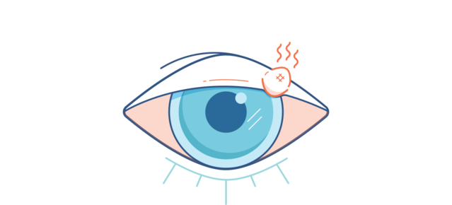 Illustration d’un oeil rouge avec un orgelet rouge et douloureux